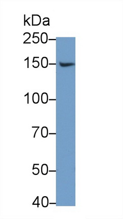 Anti-Platelet Derived Growth Factor Receptor Alpha (PDGFRa) Polyclonal Antibody