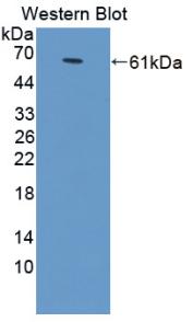 Anti-Voltage Dependent Anion Channel Protein 1 (VDAC1) Polyclonal Antibody