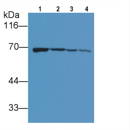 Anti-Succinate Dehydrogenase Complex Subunit A (SDHA) Polyclonal Antibody