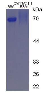 BSA Conjugated Cytokeratin Fragment Antigen 21-1 (CYFRA21-1)