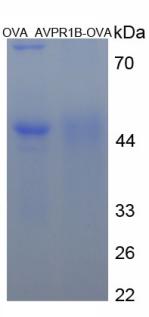 OVA Conjugated Arginine Vasopressin Receptor 1B (AVPR1B)