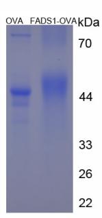 OVA Conjugated Fatty Acid Desaturase 1 (FADS1)