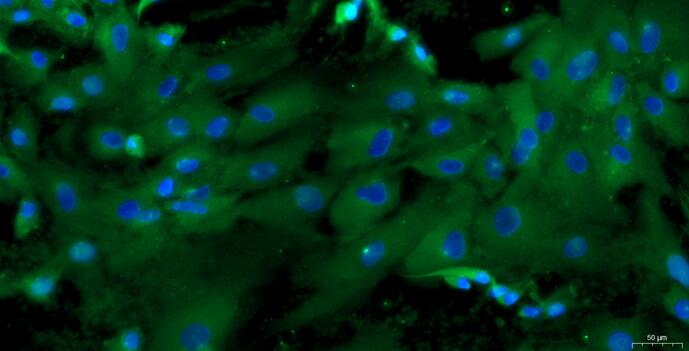 Primary Caprine Adrenal Cortical Cells (ADCC)