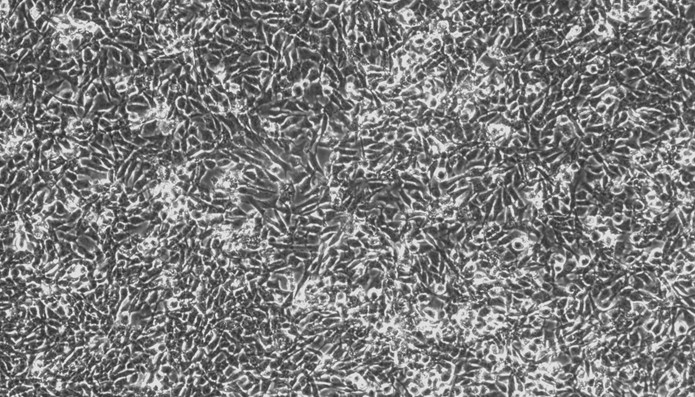 Primary Porcine Adrenal Cortical Cells (ADCC)