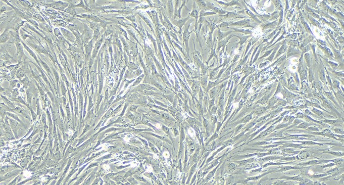 Primary Feline Cardiac Microvascular Endothelial Cells (CMEC)