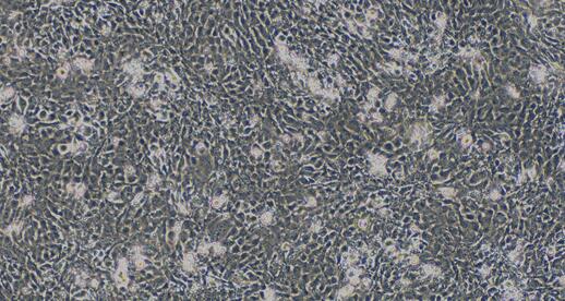 Primary Human Cardiac Microvascular Endothelial Cells (CMEC)