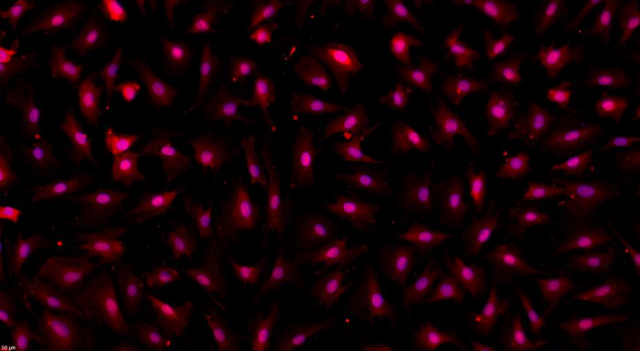 Primary Rabbit Cardiac Microvascular Endothelial Cells (CMEC)