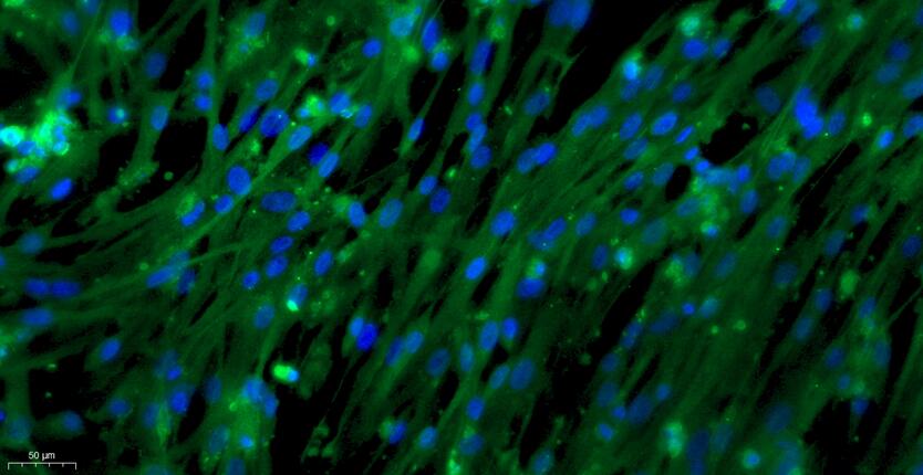 Primary Rat Aortic Endothelial Cells (AEC)