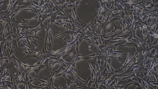 Primary Rabbit Aortic Endothelial Cells (AEC)