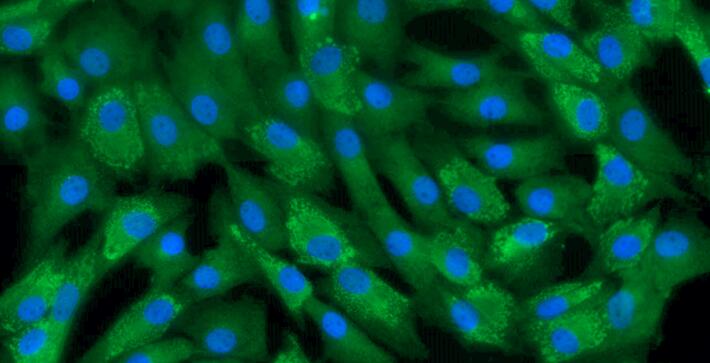 Primary Canine Annulus Fibrosus Cells (AFC)