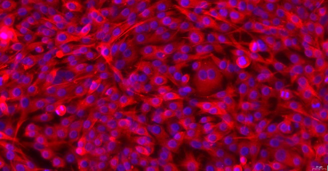 Primary Feline Annulus Fibrosus Cells (AFC)