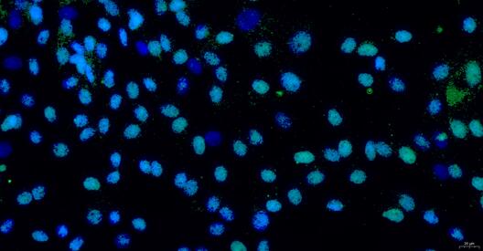 Primary Porcine Annulus Fibrosus Cells (AFC)