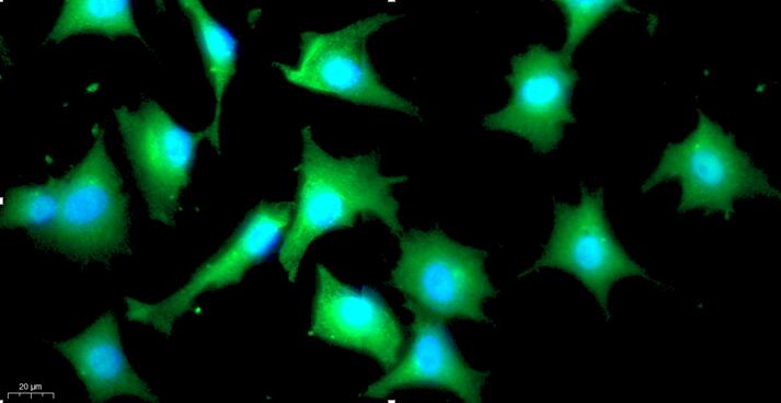 Primary Rat Annulus Fibrosus Cells (AFC)