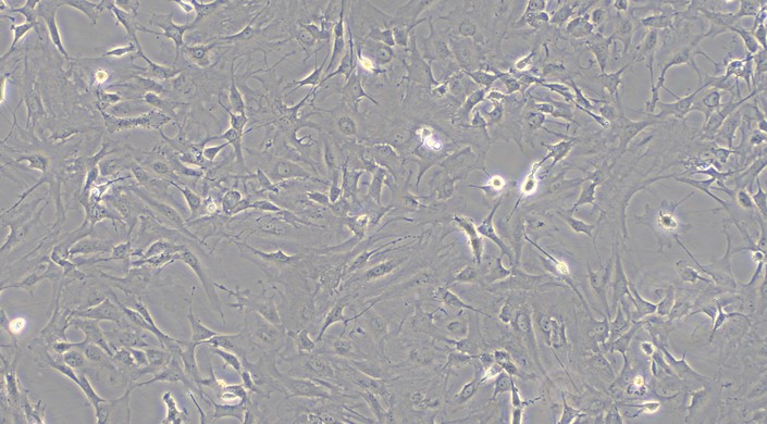 Primary Mouse Retinal Astrocytes (RA)