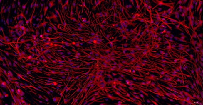 Primary Feline Brain Astrocytes (BA)