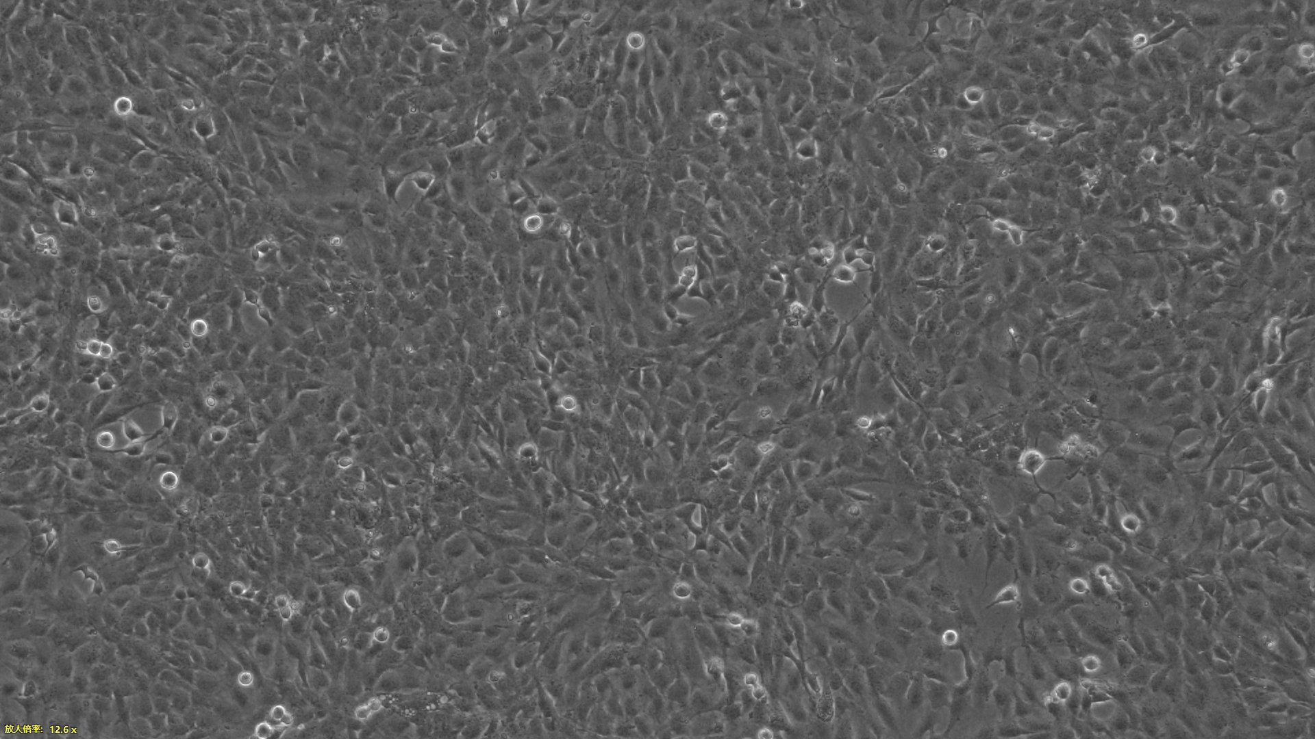 Primary Human Brain Microvascular Endothelial Cells (BMEC)