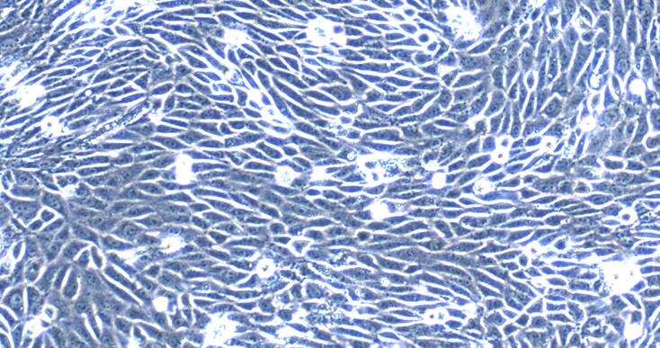Primary Mouse Brain Microvascular Endothelial Cells (BMEC)