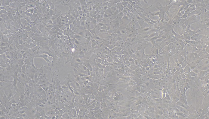 Primary Mouse Choroid Plexus Epithelial Cells (CPEC)