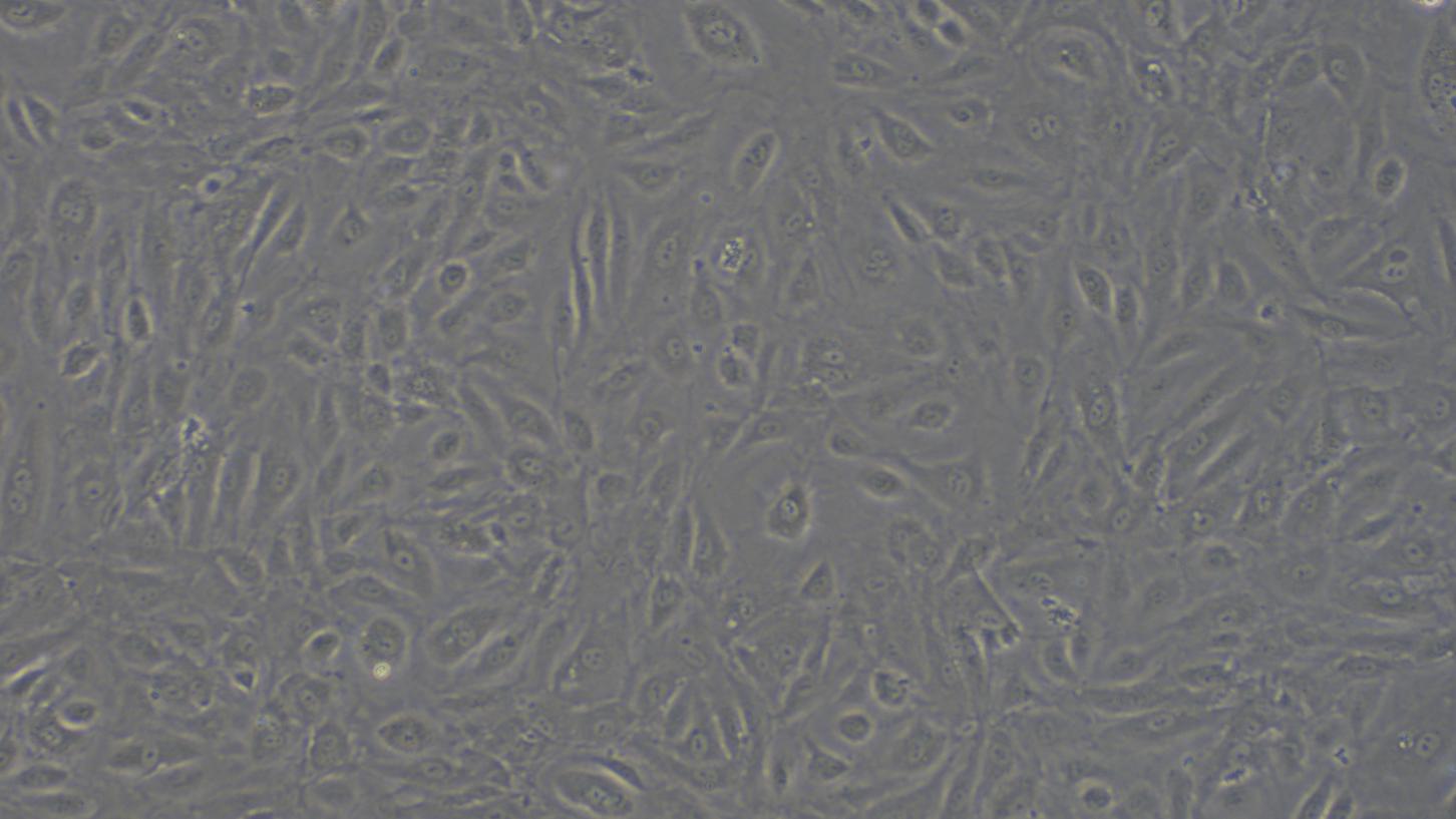Primary Human Umbilical Vein Endothelial Cells (UVEC)