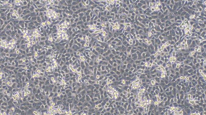 Primary Rat Corneal Epithelial Cells (CEC)