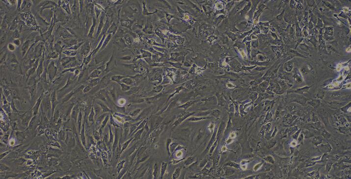 Primary Mouse Subcutaneous Preadipocytes (SPrAD)