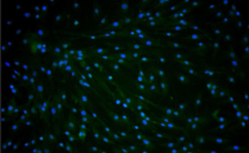 Primary Rat Subcutaneous Preadipocytes (SPrAD)