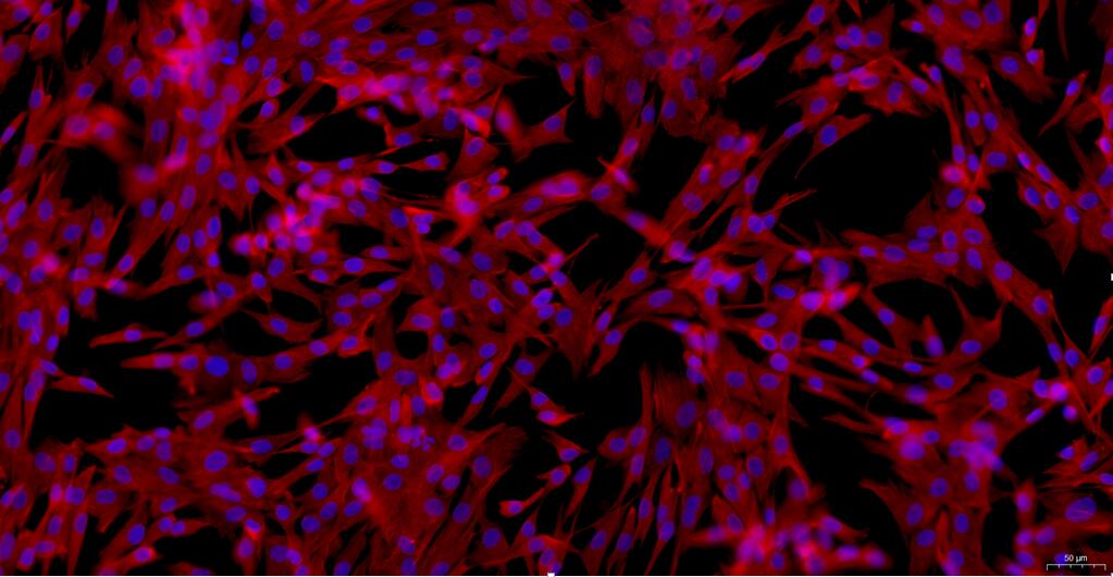 Primary Canine Pulmonary Fibroblasts (PF)