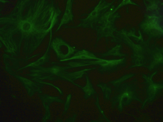 Primary Mouse Pulmonary Fibroblasts (PF)