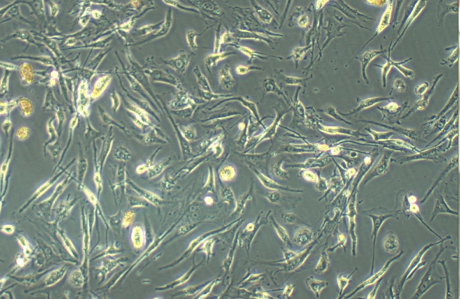 Primary Mouse Thymic Fibroblasts (TF)