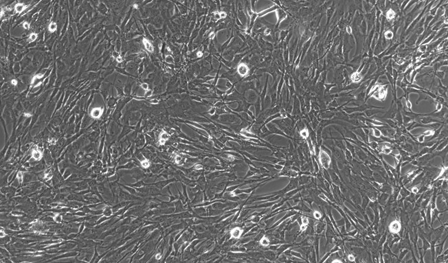 Primary Rat Choroid Plexus Fibroblasts (CPF)