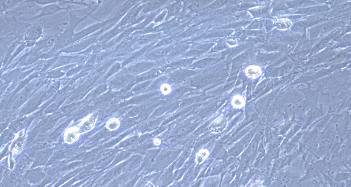 Primary Rabbit Choroid Plexus Fibroblasts (CPF)