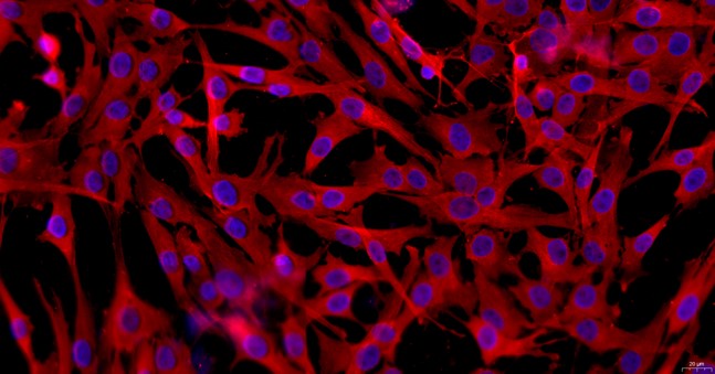 Primary Porcine Meningeal Cells (MC)