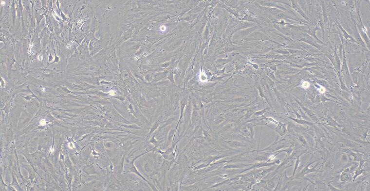 Primary Mouse Corneal Fibroblasts (CF)