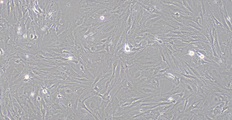 Primary Mouse Corneal Fibroblasts (CF)