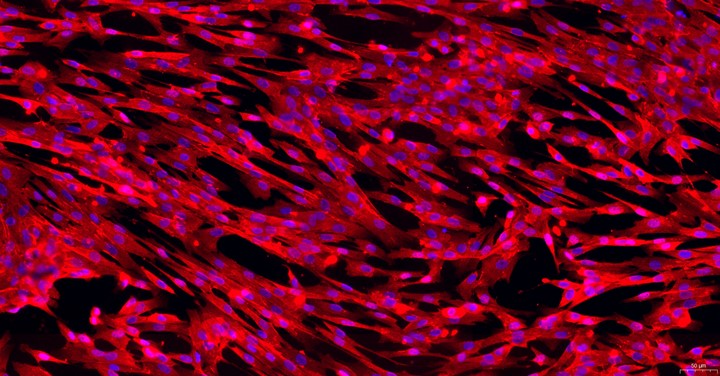Primary Canine Conjunctival Fibroblasts (CJVF)
