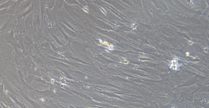 Primary Mouse Conjunctival Fibroblasts (CJVF)