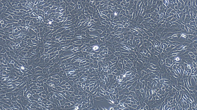Primary Rat Conjunctival Fibroblasts (CJVF)