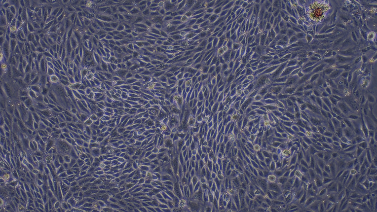 Primary Mouse Renal  Tubular Epithelial Cells (RTEC)