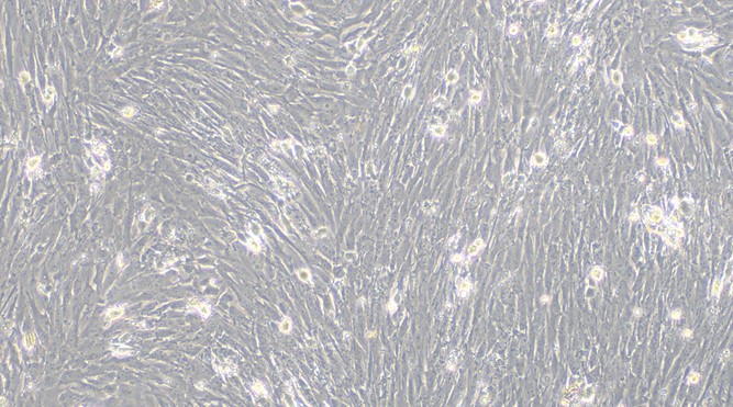 Primary Porcine Bladder Smooth Muscle Cells (BSMC)