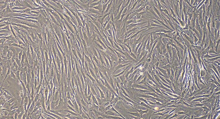 Primary Rabbit Bladder Smooth Muscle Cells (BSMC)