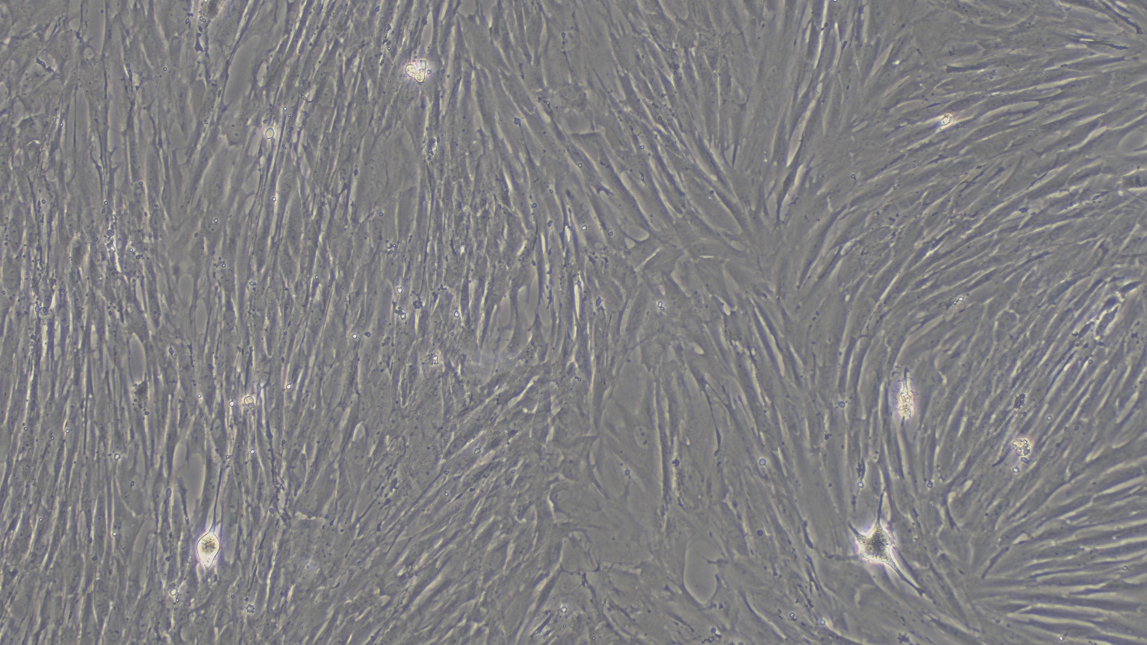Primary Mouse Bladder Stromal Fibroblasts (BSF)