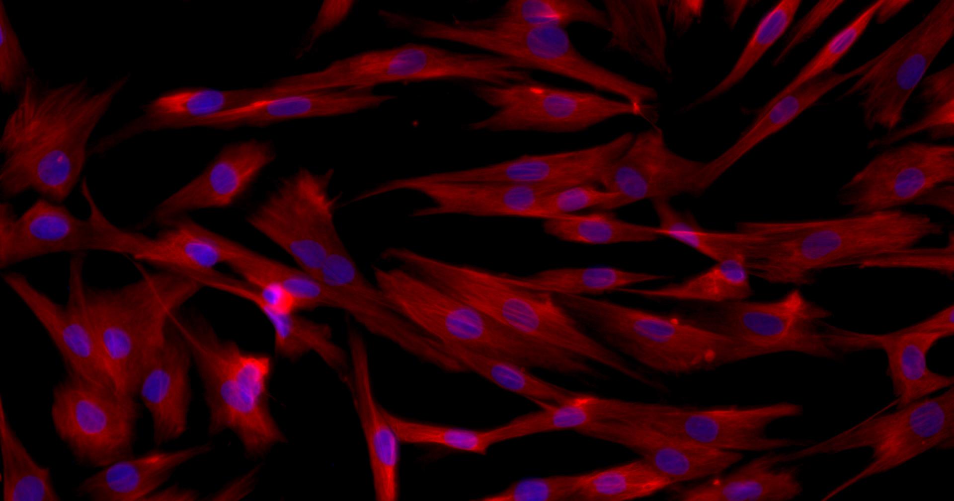 Primary Rabbit Bladder Stromal Fibroblasts (BSF)