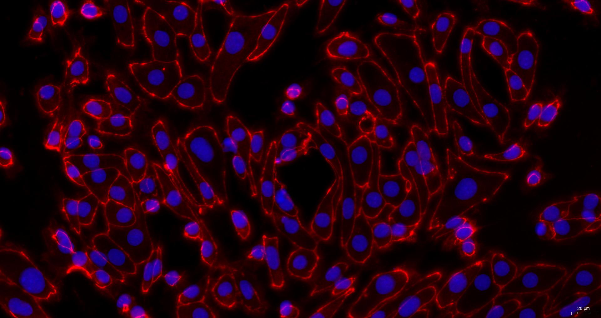 Primary Mouse Renal Cortical Epithelial Cells (RCEC)