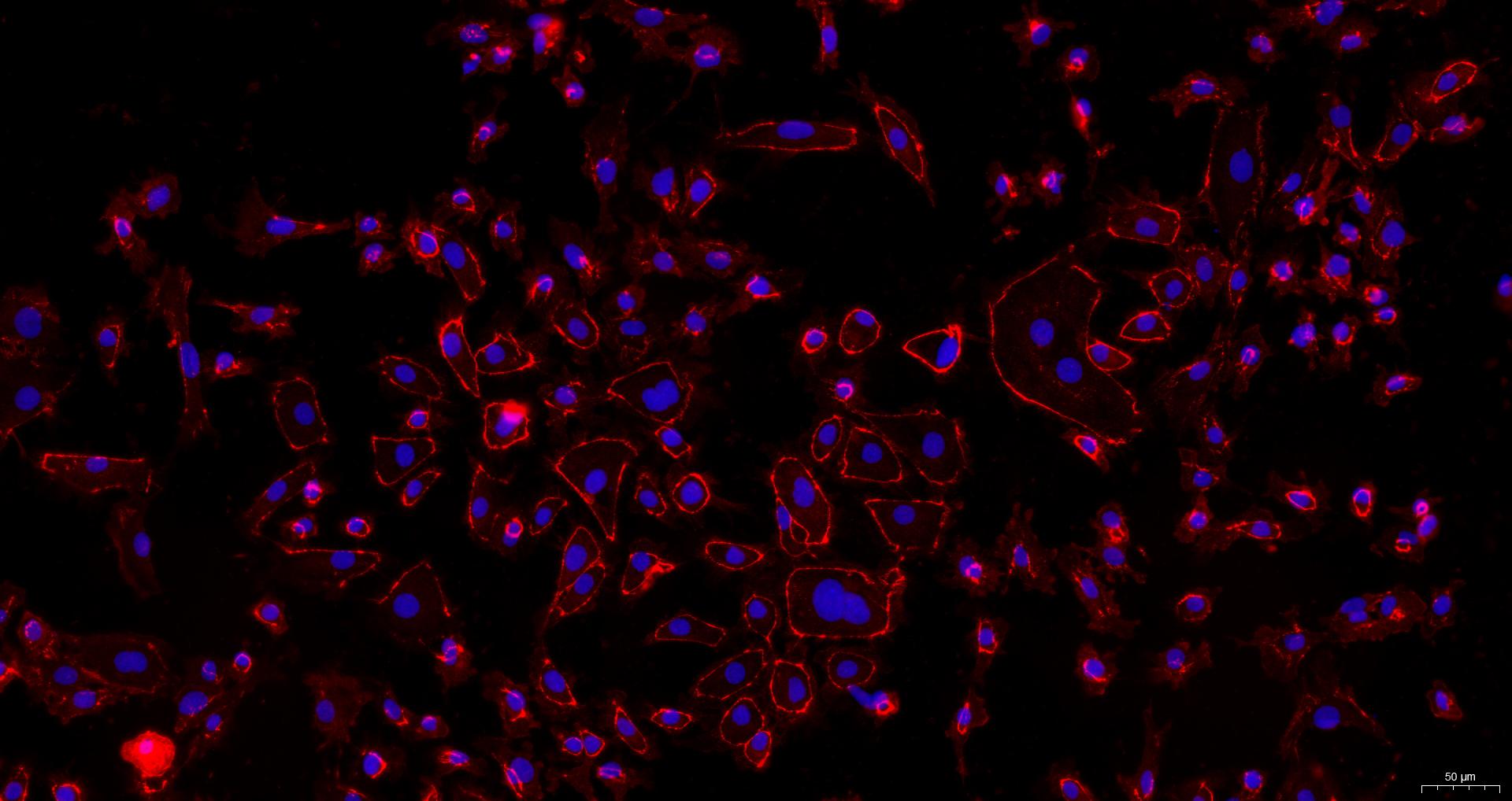 Primary Rabbit Renal Cortical Epithelial Cells (RCEC)