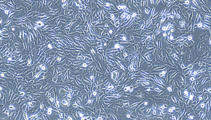 Primary Feline Tracheal Smooth Muscle Cells (TSMC)