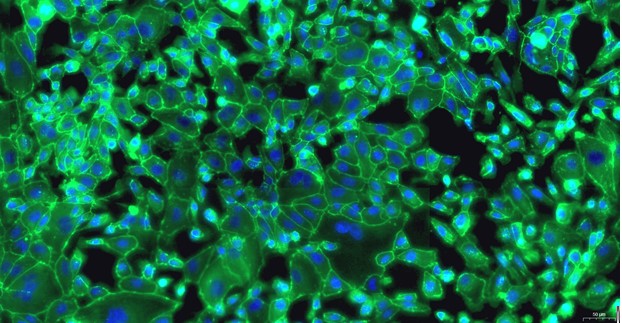Primary Ovine Tracheal Epithelial Cells (TEC)