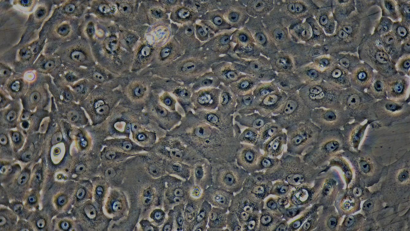 Primary Rabbit Tracheal Epithelial Cells (TEC)