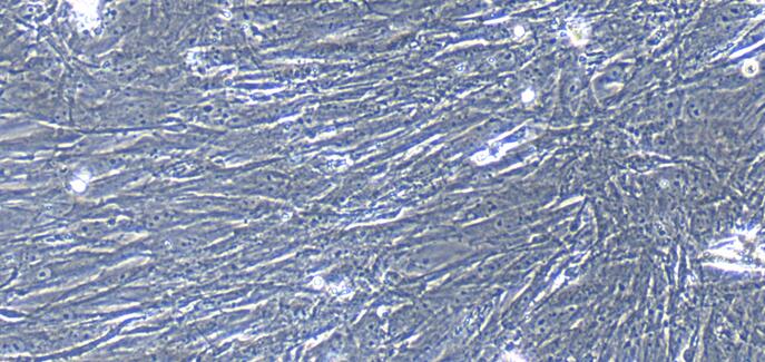 Primary Mouse Intestinal Fibroblasts (IF)