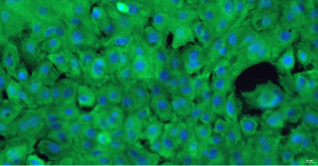 Primary Canine Adult Epidermal Keratinocytes (AEK)