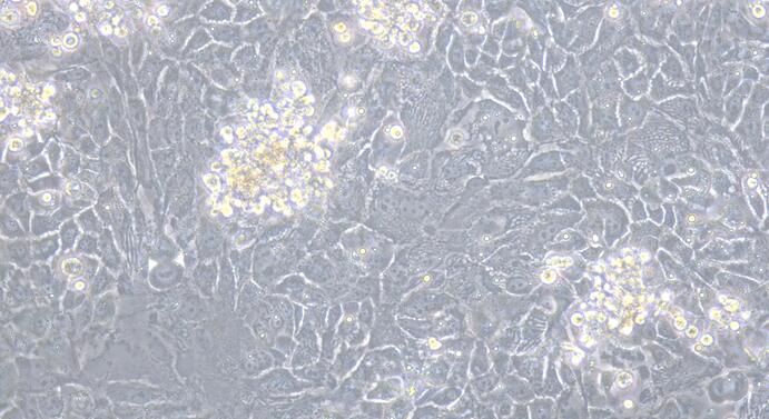 Primary Human Adult Epidermal Keratinocytes (AEK)